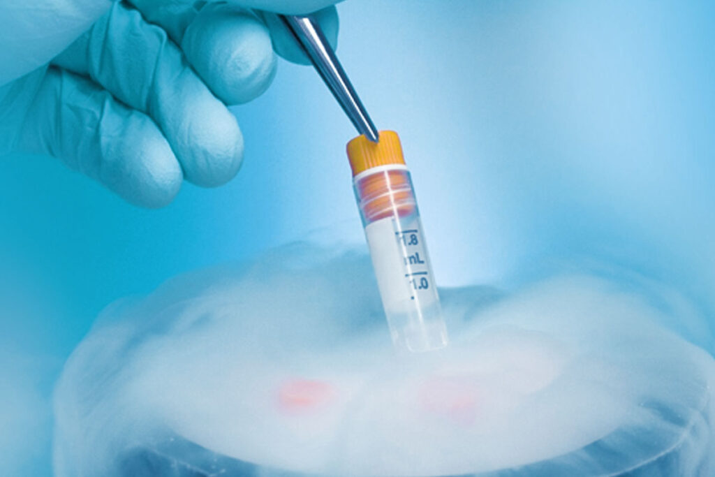 Fertility Centre in Junagadh	best ivf center in junagadh	ICSI treatment in Junagadh