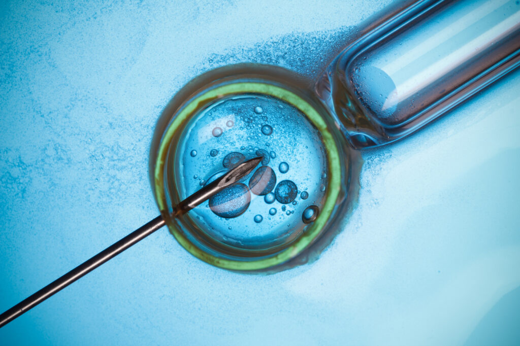 Fertility Centre in Junagadh	best ivf center in junagadh	ICSI treatment in Junagadh