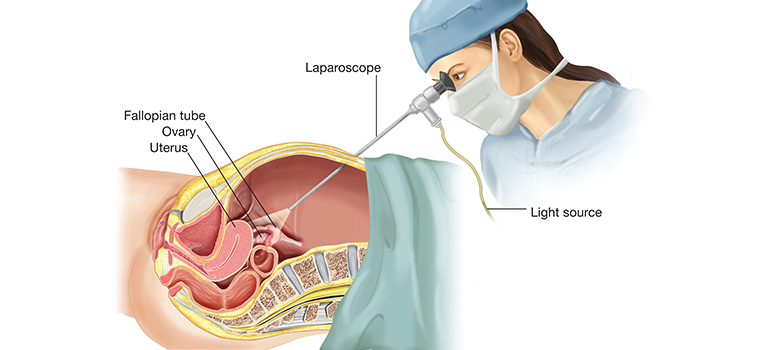 Fertility Centre in Junagadh	best ivf center in junagadh	ICSI treatment in Junagadh