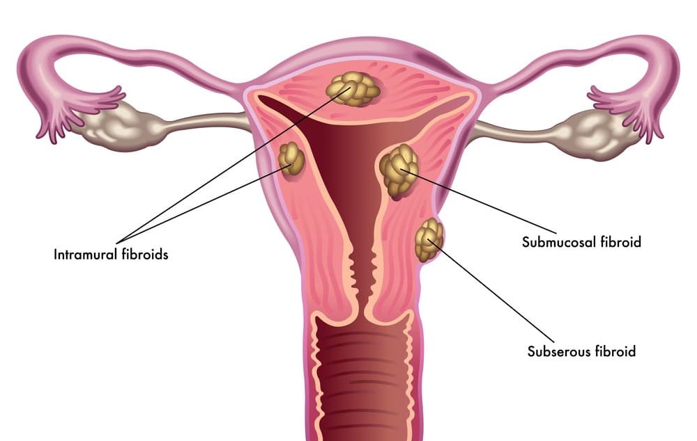 Fertility Centre in Junagadh	best ivf center in junagadh	ICSI treatment in Junagadh