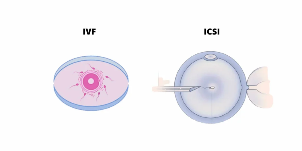 Fertility Centre in Junagadh	best ivf center in junagadh	ICSI treatment in Junagadh