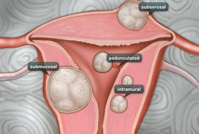 Fertility Centre in Junagadh	best ivf center in junagadh	ICSI treatment in Junagadh