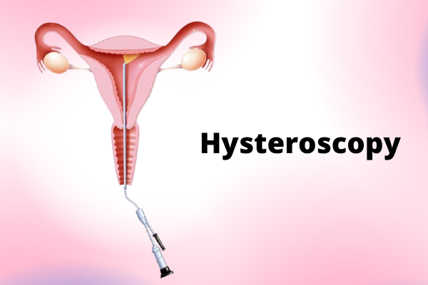 hysteroscopy in infertility, ICSI treatment in Junagadh, best IVF center in Junagadh, fertility center in Junagadh, hysteroscopy procedure, uterine health and fertility, infertility treatment in Junagadh, IVF success rates, uterine abnormalities, fertility specialists in Junagadh, hysteroscopy benefits, minimally invasive fertility treatment, embryo implantation, recurrent miscarriages treatment, fertility care in Junagadh, assisted reproductive techniques, uterine polyps and fibroids, best fertility doctor in Junagadh, hysteroscopy for IVF, pregnancy after hysteroscopy