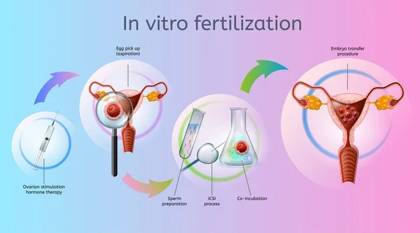 Fertility Centre in Junagadh	
best ivf center in junagadh	
ICSI treatment in Junagadh
