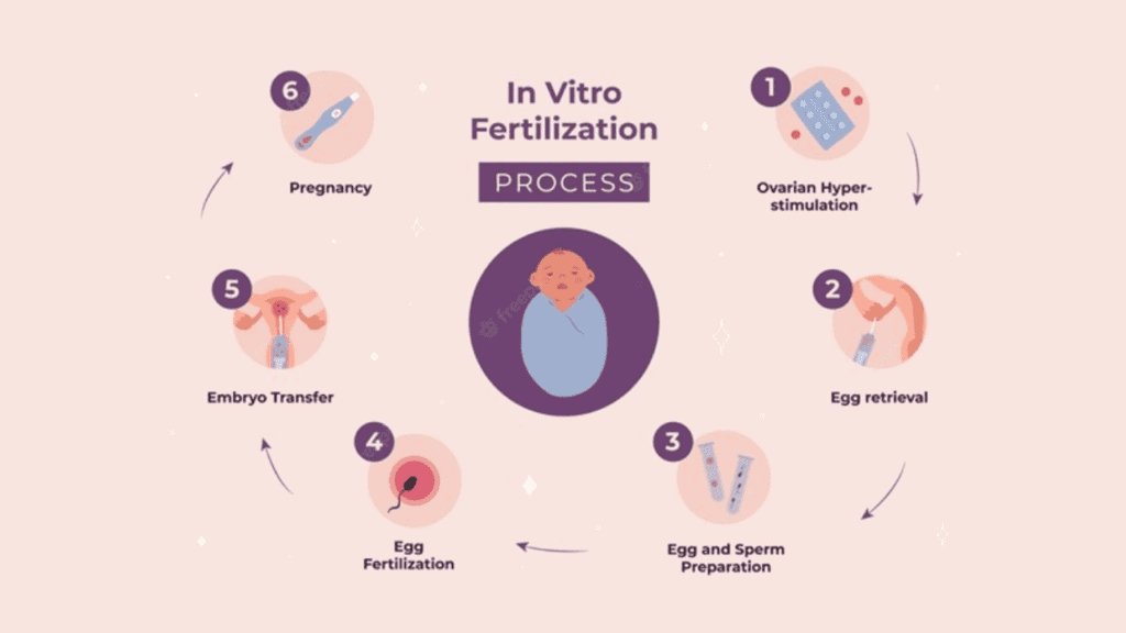 best IVF center in Junagadh, IVF treatment in Junagadh, fertility center in Junagadh, ICSI treatment in Junagadh, IVF procedure step by step, infertility treatment in Junagadh, embryo transfer, egg retrieval process, male fertility test, female fertility test, IVF success rates, assisted reproductive technology, pregnancy after IVF, best fertility clinic in Junagadh, hormonal injections for IVF, embryo freezing, IVF pregnancy confirmation