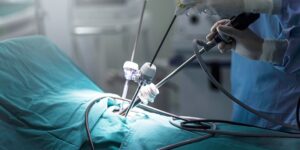 stitchless surgery Junagadh, laparoscopic surgery without stitches, keyhole surgery Junagadh, minimally invasive gynecological surgery, best IVF center in Junagadh, laparoscopic fertility surgery, stitchless fibroid removal, laparoscopic endometriosis treatment, blocked fallopian tube surgery, Unique IVF Hospital Junagadh, ICSI treatment Junagadh, advanced fertility treatment Junagadh, laparoscopic uterus surgery, gynec laparoscopy Junagadh
