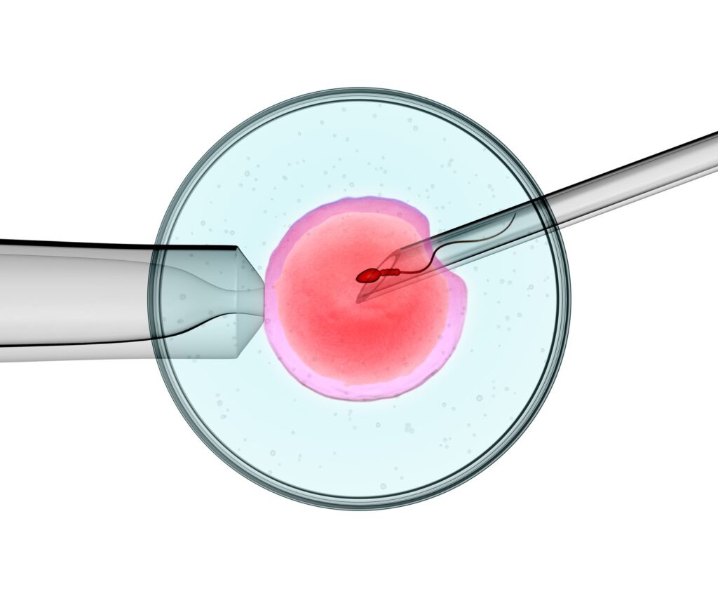 IVF in Junagadh, best IVF center in Junagadh, ICSI treatment in Junagadh, normalize IVF, Isha Ambani IVF story, IVF support in India, emotional IVF journey, IVF success stories, male infertility solutions, best fertility Centre in Junagadh, IVF stigma, IVF emotional support, IVF awareness India, fertility care Junagadh