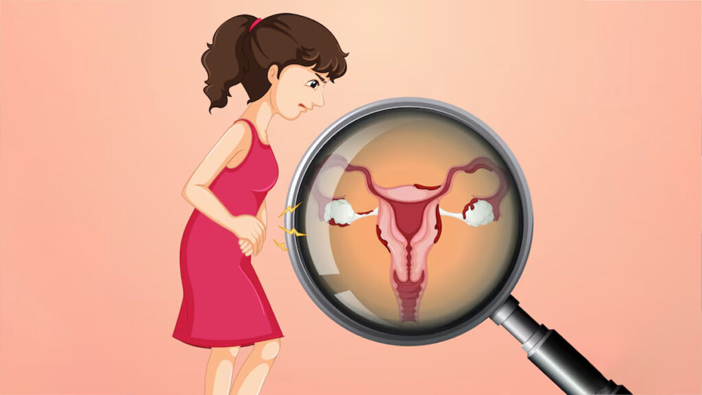 uterine cancer symptoms, early signs of uterine cancer, endometrial cancer awareness, fertility centre in Junagadh, best IVF center in Junagadh, Unique IVF Hospital, ICSI treatment Junagadh, women’s reproductive health, gynecology hospital Junagadh, postmenopausal bleeding, uterine cancer diagnosis, reproductive health care