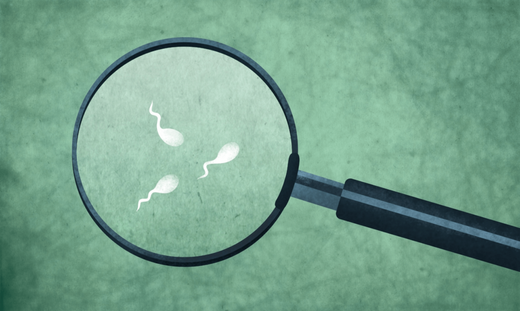 male infertility testing, male fertility check-up Junagadh, semen analysis Junagadh, hormone test for male fertility, genetic test for infertility, best IVF center in Junagadh, ICSI treatment in Junagadh, fertility centres in Junagadh, testicular biopsy for infertility, male reproductive health, Unique IVF Hospital Junagadh, fertility evaluation for men, varicocele diagnosis Junagadh, infertility tests for men, sperm motility analysis Junagadh