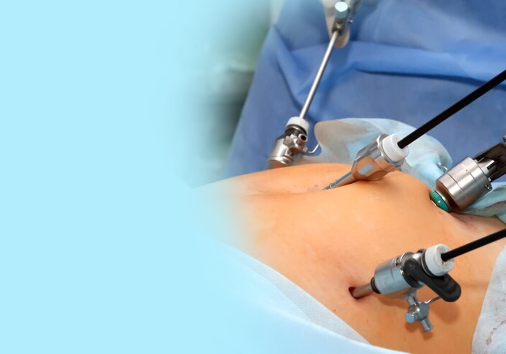 laparoscopy surgery in Junagadh, advanced laparoscopy surgery, fertility centre in Junagadh, best IVF center in Junagadh, Unique IVF Hospital Junagadh, Dr. Pravin M. Dudhat, gynecological laparoscopy, painless laparoscopy surgery, ICSI treatment in Junagadh, minimally invasive surgery Junagadh, laparoscopic fertility treatment, endometriosis laparoscopy Junagadh, ovarian cyst treatment Junagadh, female infertility surgery Junagadh, reproductive surgery in Junagadh, IVF and laparoscopy center Junagadh