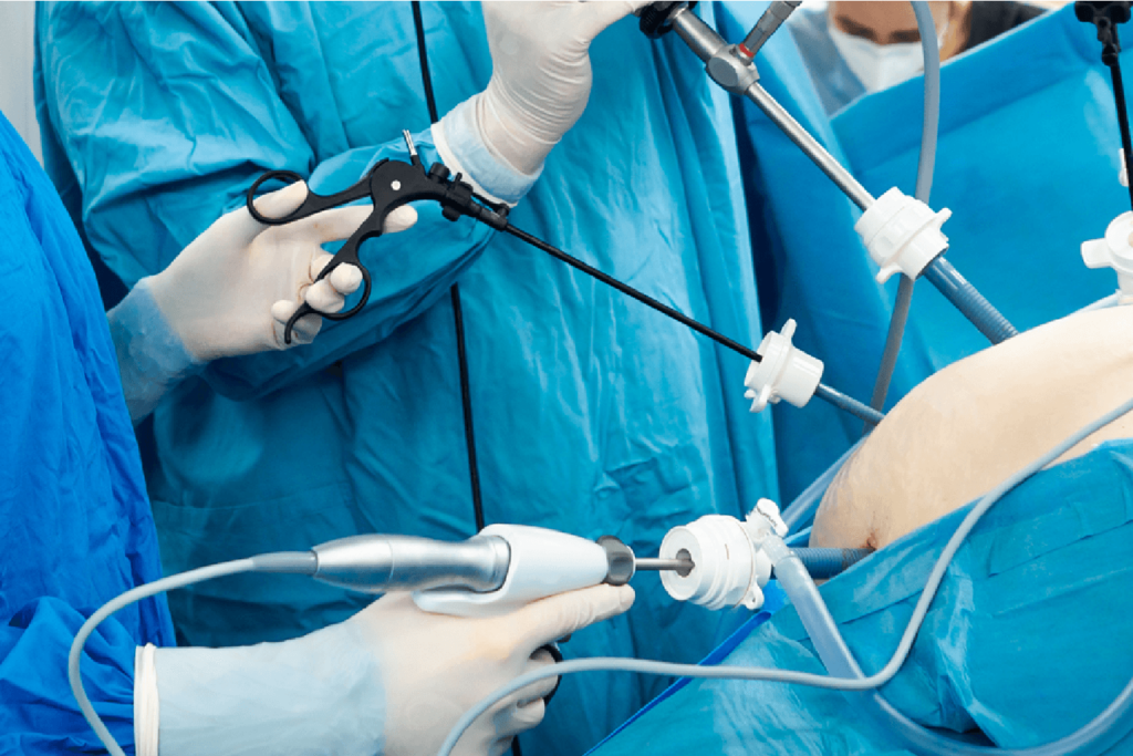 laparoscopy surgery in Junagadh, advanced laparoscopy surgery, fertility centre in Junagadh, best IVF center in Junagadh, Unique IVF Hospital Junagadh, Dr. Pravin M. Dudhat, gynecological laparoscopy, painless laparoscopy surgery, ICSI treatment in Junagadh, minimally invasive surgery Junagadh, laparoscopic fertility treatment, endometriosis laparoscopy Junagadh, ovarian cyst treatment Junagadh, female infertility surgery Junagadh, reproductive surgery in Junagadh, IVF and laparoscopy center Junagadh