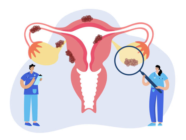 gynecological cancers, ovarian cancer awareness, cervical cancer prevention, uterine cancer symptoms, best IVF center in Junagadh, Unique IVF Hospital Junagadh, ICSI treatment in Junagadh, women's reproductive health Junagadh, HPV and cervical cancer, gynecology and fertility care, vulvar cancer symptoms, vaginal cancer screening, early detection of female cancers, endometrial cancer diagnosis, fertility centre Junagadh, cancer screening for women, holistic women’s health care