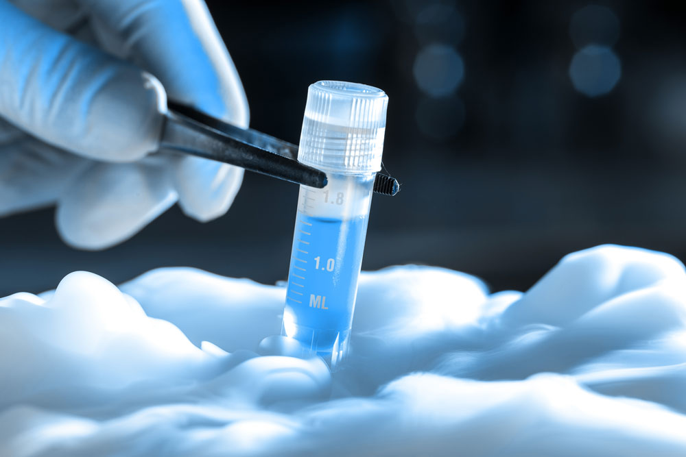 sperm freezing in Junagadh, fertility preservation Junagadh, best IVF center in Junagadh, ICSI treatment in Junagadh, male fertility solutions, cryopreservation of sperm, delay parenthood options, sperm cryopreservation Junagadh, fertility centre in Junagadh, Unique IVF Hospital Junagadh