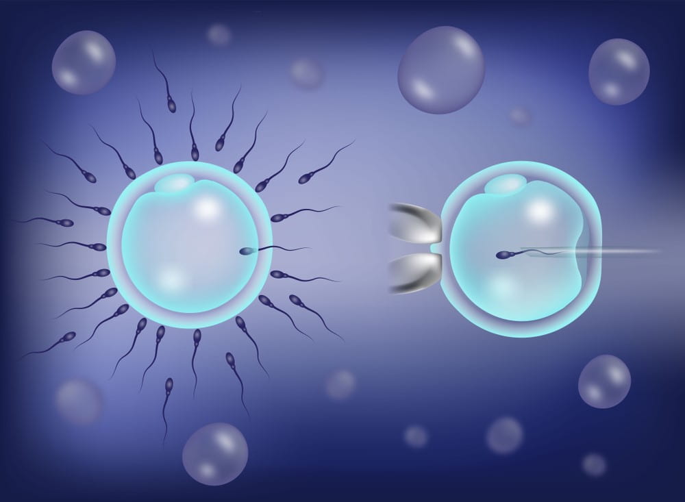 Unique IVF Hospital Junagadh, best IVF center in Junagadh, fertility centre in Junagadh, egg quality and fertility, how to improve egg quality, lifestyle tips for egg health, ICSI treatment in Junagadh, IVF success and egg quality, reproductive health Junagadh, fertility diet tips, egg preservation Junagadh, women’s fertility care Junagadh, stress and fertility, healthy lifestyle for conception, improving female fertility naturally, fertility expert Junagadh