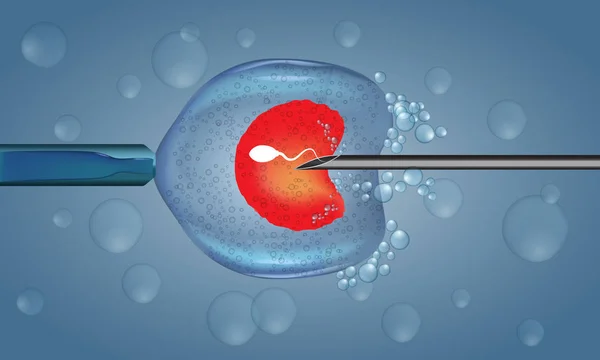 IVF treatment Junagadh, ICSI treatment Junagadh, best IVF center Junagadh, fertility centre Junagadh, infertility solutions, assisted reproductive technology, male infertility treatment, female infertility treatment, egg retrieval Junagadh, embryo transfer Junagadh
