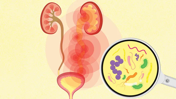 urine infection during pregnancy Junagadh, pregnancy urinary infection Junagadh, UTI in pregnancy Junagadh, maternal health Junagadh, Unique IVF Hospital, best IVF center Junagadh, ICSI treatment Junagadh, fertility centre in Junagadh, prenatal care Junagadh, pregnancy health tips