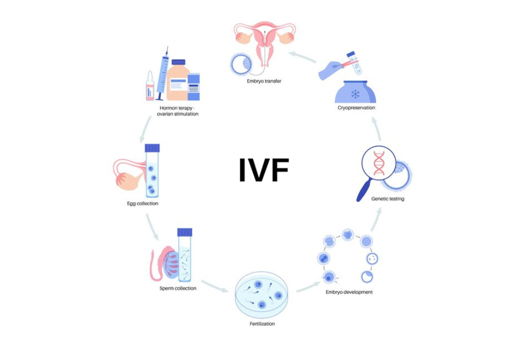 IVF treatment in Junagadh, IVF step by step guide, IVF process explained, IVF for couples in Junagadh, Unique IVF Center Junagadh, Dr Pravin M Dudhat IVF specialist, infertility treatment Junagadh, IVF success tips, IVF consultation Junagadh, fertility treatment Gujarat, IVF procedure India, IVF for blocked tubes, IVF for low sperm count, PCOS infertility treatment, endometriosis infertility treatment, ICSI treatment Junagadh, embryo transfer process, egg retrieval procedure, semen analysis IVF, IVF pregnancy test, IVF specialist Junagadh, best IVF center in Junagadh, IVF journey India, IVF lab fertilization, IVF embryo development, IVF luteal support, IVF success rate factors