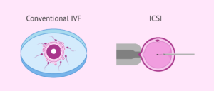 IVF center Junagadh, best IVF center in Junagadh, fertility centre Junagadh, IVF treatment Junagadh, ICSI treatment Junagadh, infertility treatment Junagadh, fertility clinic Junagadh, test tube baby center Junagadh, PCOS fertility treatment, male infertility treatment, female infertility solutions, advanced fertility treatments India, IVF success rate Junagadh, reproductive health clinic Junagadh, parenthood journey IVF